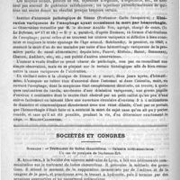 0300 - Page 296 - Revue des journaux. Journaux italiens. Sur la valeur des divers moyens de traitement des gonflements chroniques de la rate (suite de malaria) (Gazetta degli ospitali, n° 8) / Ulcération variqueuse de l'oesophage ayant occasionné la mort par hémorrhagie (In La Reforma, n°s 17 et 18) [Millot-Carpentier] / Sociétés et Congrès. Sommaire : - Traitement du bubon chancrelleux. - Balanite médicamenteuse. Un cas de paralysie de Duchenne-Erb
