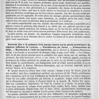 0723 - Page 711 - Revue trimestrielle d'obstétrique et de gynécologie. L'opération césarienne moderne ; manuel opératoire, par J. Potocki (Annales de gyn., décembre 1889) / Dystocie due à la présence d'un myome inséré sur la partie postérieure du segment inférieur de l'utérus. - Putréfaction du foetus. - Présentation du siège. - Extraction à l'aide du basiotribe, par le docteur A. Ribemont-Dessaignes (Ann. de gyn., avril 1890)