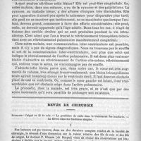 0158 - Page 150 - Hôpital de la Charité. - M. le Professeur Potain. Rétrécissement et insuffisance de la valvule tricuspide / Revue de chirurgie. Sommaire : Catgut ou fil de soie. - La gouttière de sable dans le traitement des fractures. - La fièvre dans les fractures simples (Arch. f. Klin. chir., 1891, t. TLI)
