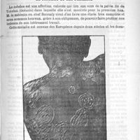 0377 - Page 373 - Sommaire / Le tokelau et son parasite