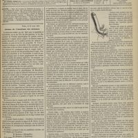 0147 - Page 137 - Sommaire / Séance de l'Académie des sciences. [Dr Brochin] / Hôpital Necker. M. Civiale. Des rétrécissements infranchissables et de l'uréthrotomie externe