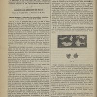0072 - Page 62 - Société médicale des hôpitaux. Séance du 26 octobre 1872. Communications. M. Dujardin-Beaumetz : Note complémentaire sur les altérations des tubes en caoutchouc par les solutions iodées / Lecture / Société de médecine de Paris. Séance du 19 juillet 1872. Moyens propres à détacher les concrétions calcaires adhérentes aux parois de la vessie