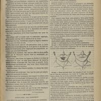 0693 - Page 683 - Revue clinique hebdomadaire. Promenade des les hôpitaux. De l'azoturie / Autoplastie par glissement à la suite d'une morsure de chien ; guérison dans difformité ; par M. le Docteur Millot