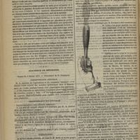 0118 - Page 110 - Hôpital de Ham. M. Surmay. Hernie entéro-épiploïque étranglée depuis huit jours. - Opération. - Intestin largement gangrené. - Anus contre nature. - Guérison au bout de six mois, après avivement et suture des bords de l'orifice anormal / Académie de médecine. Séance du 2 février 1875. Correspondance officielle / Correspondance non officielle / Présentations / Présentations d'instruments. M. le Professeur Richet : Nouvelle pince à réduire les luxations des phalanges
