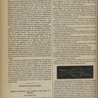0464 - Page 452 - Royal College of Surgeons. M. Tim. Holmes. Leçons sur le traitement des anévrysmes. (Traduites de l'anglais par le Dr C. Caussidou) / Optique physiologique. Mesure du diamètre de la pupille et des cercles de diffusion. Par le Docteur Badal