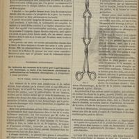 0638 - Page 626 - Revue de policlinique. Policlinique chirurgicale. Ablation d'un cancer du sein droit. - Guérison. Par M. le Docteur Bilhaut... / Policlinique gynécologique. De l'ablation des tumeurs de la vulve par la galvanocaustie thermique, à l'aide d'un instrument produisant la pédiculisation et l'ischémie chirurgicale : le forcipresseur à lames parallèles. Par M. Chéron...