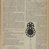 1087 - Page 1075 - Clinique des maladies des yeux. M. Adolphe Piéchaud. Nouvelle observation de kératite parenchymateuse / Ophthalmoscope à réfraction ; par M. le Docteur Badal