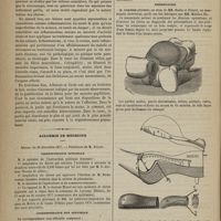 1184 - Page 1172 - Hôtel-Dieu de Marseille. M. A. Fabre. La myocardite palustre et la myocardite puerpérale. (Leçons recueillies par le Docteur Garcin...) / Académie de médecine. Séance du 18 décembre 1877. Correspondance officielle / Correspondance non officielle / Présentation