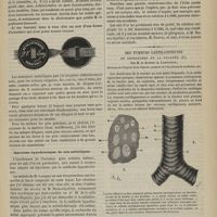0775 - Page 763 - Hôpital de la Pitié. M. Lasègue. Conférence sur la métallothérapie. Faite le 13 juin 1878, sur l'invitation de M. le Professeur Lasègue, par le Dr V. Burq / Des tumeurs cartilagineuses ou chondromes de la trachée, par M. le Docteur A. Laboulbène...