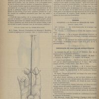 1170 - Page 1158 - Instruments et appareils. Gambetto, appareil pour maintenir le cathéter en permanence dans la vessie. Par le Docteur Gaetano Teserone / Thèses soutenues à la Faculté de médecine de Paris pendant l'année 1878 / Chronique et nouvelles scientifiques. Corps de santé militaire / Faculté de médecine de Bordeaux / Faculté des sciences de Marseille
