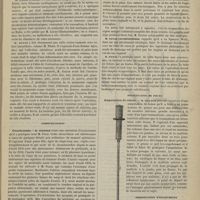 0103 - Page 101 - Société de chirurgie. Séance du 18 décembre 1878. M. Delens, sur deux communications adressées par M. Pilate... : Kyste multiloculaire axillaire / Communications. Ovariotomie. M. Terrier, pratiquée avec M. Pozzi / Présentation de pièces. Amputation de cuisse. M. Tillaux / Présentation d'instruments