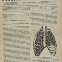 0323 - Page 321 - Sommaire / Hôpital Lariboisière. M. Constantin Paul. Rétrécissement acquis de l'artère pulmonaire. - Phthisie consécutive