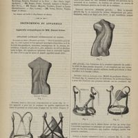 1032 - Page 1030 - Société de chirurgie. Séance du 5 novembre 1879. Présentation de malades. Polypes naso-pharyngiens. M. Verneuil / Élections / Instruments et appareils. Appareils orthopédiques de MM. Rainal frères