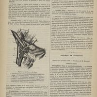 1038 - Page 1036 - Médecine opératoire. A propos de la ligature de l'artère linguale / Société de biologie. Séance du 8 novembre 1879. Communications. De l'aphasie dans la paralysie générale. M. Magnan