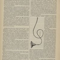 1096 - Page 1094 - Académie de médecine. Séance du 25 novembre 1879. Lectures. M. Bucquoy : Du pneumothorax sans communication de la plèvre avec l'air extérieur, consécutif à la thoracentèse par aspiration / M. Burq : La métallothérapie à Vichy de 1870 à 1873 contre le diabète et subsidiairement de l'association des métaux à la médication alcaline pour en augmenter et corriger les effets / Présentation d'instruments