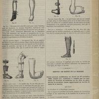 0265 - Page 253 - Instruments et appareils. Appareils orthopédiques de MM. Rainal Frères / Service de santé de la marine. Décret portant modification au décret du 27 novembre 1880, relatif aux conditions à remplir par les aspirants au doctorat en médecine ou au titre de pharmacien de première classe, appartenant au service de santé de la marine