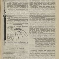 0449 - Page 437 - Instruments et appareils. Nouveau type de cautère Paquelin (fig. 3) / Tracteur de la commissure des lèvres pendant la chloroformisation / Les accoucheurs des hôpitaux