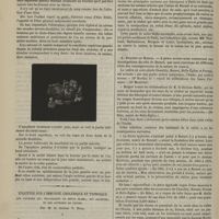 1088 - Page 1076 - Necrose des maxillaires inférieur et supérieur gauches. Chute du supérieur. Par M. le Docteur Léon Dufour / Enquêtes sur l'immunité cholérique et typhoïque des ouvriers qui travaillent le métal blanc, dit alfénide, et des ouvriers en cuivre. Par M. le Docteur V. Burq