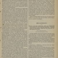 0013 - Page 3 - Hôpital Saint-Louis. M. Fournier. La période préataxique du tabes d'origine syphilitique / Métallothérapie. Pied bot varus par contracture, guéri par l'application d'une armature de cuivre pendant une heure. - Hystérie datant de deux années ; disparition des crises par l'argent extra et l'or intus. Par le Docteur Moricourt...