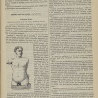 1149 - Page 1139 - Hôpital de la Charité. M. Hardy. Un cas d'occlusion intestinale / Hôtel-Dieu de Lyon. M. A. Poncet. L'homme-tronc. Observation recueillie par M. Ch. Audry...