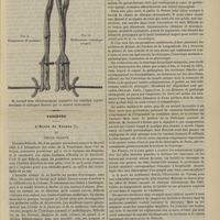 0041 - Page 29 - Instruments et appareils. Embryotome céphalique combiné / Variétés. L'École de Vienne