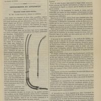 0169 - Page 157 - Société de chirurgie. Séance du 6 février 1889. Correspondances. Tumeur de la queue du sourcil, d'origine traumatique, prise pour une tumeur dermoïde. M. Larger / Instruments et appareils. Nouvelle sonde intra-utérine, de Mme Gaches-Sarraute...