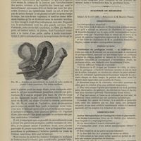 0408 - Page 396 - Hôpital Saint-Louis. M. Péan. Du morcellement appliqué à l'ablation des tumeurs. (Leçons recueillies par M. Lapervenche...) / Académie de médecine. Séance du 9 avril 1889. Correspondance / Présentations. Traitement du prolapsus rectal. M. Verneuil, une note de M. Jeannel / Communication. Action thérapeutique de l'antipyrine dans la glycosurie. M. Panas