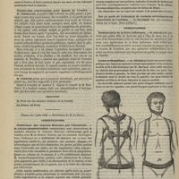 0612 - Page 600 - Société de chirurgie. Séance du 29 mai 1889. Communications. Arthrodèse pour pied bot paralytique. M. Defontaine / Trente-cinq ovariotomies pour kystes de l'ovaire. M. Terrillon / Élection / Séance du 5 juin 1889. Communications. Traitement des tumeurs fibreuses par l'électricité. M. Lucas-Championnière communique sept observations et traitées avec M. le Docteur Donion / Présentations. Restauration de la lèvre inférieure. M. Polaillon / Corset orthopédique. M. Périer présente un nouveau modèle qu'il a fait fabriquer par M. Mariaud