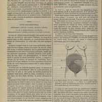 0870 - Page 858 - Hôpital de la Charité. M. Luys. Accouchement en état de fascination ; insensibilité complète pendant la période d'expulsion ; régularisation des contractions ; amnésie totale au réveil. Par M. le Docteur De Grandchamps... / Kyste sous-péritonéal probablement d'origine ovarique ; ablation ; guérison. Par M. le Docteur Heurtaux...