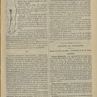 0197 - Page 197 - Revue générale. Des jambes en ciseaux consécutives aux affections de la hanche, coxalgie, etc. Par le Docteur L.-H. Petit... VI. Traitement / VII. Traitement préventif ou prophylactique / Société de chirurgie. Séance du 12 février 1895. Rapports. Tumeur abdominale. M. Routier, rapport sur une observation adressée par M. Potherat / Hémarthrose du genou. M. Félizet / Luxation métatarso-phalangienne. M. Delorme