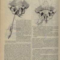 0784 - Page 812 - Revue générale. Description et mode d'emploi du préhenseur-levier-mensurateur. Par M. le Professeur L.-H. Farabeuf. V. Introduction et placement de la cuillère antérieure / VI. Articulation, vérification, rectification