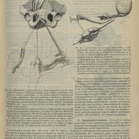 0785 - Page 813 - Revue générale. Description et mode d'emploi du préhenseur-levier-mensurateur. Par M. le Professeur L.-H. Farabeuf. VI. Articulation, vérification, rectification / VII. Engagement et descente