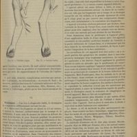 0309 - Page 299 - Revue générale. Les fractures du coude, en particulier chez les jeunes sujets. Par le Docteur Albert Mouchet... VIII. Pronostic. Complications / IX. Traitement