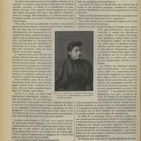 0470 - Page 464 - Revue générale. Des adénites géniennes (adénites de A. Poncet). Revue anatomique et clinique. Par M. Léon Thévenot... II. Pathologie / III. Diagnostic des adénites géniennes