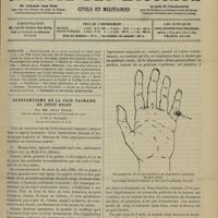 1381 - Page 1375 - Sommaire / Botryomycome de la face palmaire du petit doigt ; par MM. Xavier Delore... et Ch.-L Gauthier
