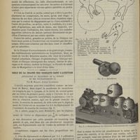 0244 - Page 238 - La nouvelle maternité de Montpellier. II. La clinique d'accouchements et de gynécologie. Par M. P. Puech... / Rôle de la chaîne des osselets dans l'audition. Application au traitement de la surdité et des bourdonnements ; par M. Marage...