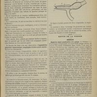 0327 - Page 329 - Séance de l'Académie de médecine. (19 mars 1901). M. Robin : Conditions et le diagnostic du terrain de la tuberculose / Monstre xyphophage : M. Chapot-Prévost / M. Barette : Appendicite gangrenée hypertoxique compliquée d'ictère grave mortel / M. Golesceano : Lavage des oreilles / Revue de la presse. Médecine. Néphrite aiguë consécutive à la grippe. (Arch. of Pediatrics, oct. 1900) / Voies urinaires. Corps étrangers de l'urètre