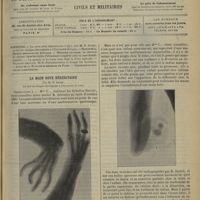 0343 - Page 345 - Sommaire / La main bote héréditaire ; par M. G. Gayet...