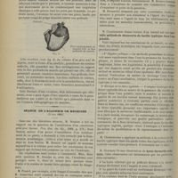 0616 - Page 618 - Fracture d'une exostose épiphysaire du fémur. Pseudarthrose ; par M. Roger Dupouy... / Séance de l'Académie de médecine. (4 juin 1901). M. Chantemesse : Nouvelle méthode de découverte du bacille typhique dans l'eau potable / M. Chavasse : Kyste dermoïde orbitaire