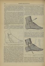 Fig. 2. Incision des téguments (trait plein pour Pirogoff-Sédillot, trait pointillé pour Pasquier-Le [...]