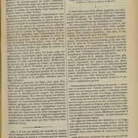 0291 - Page 281 - Leçons de pratique médicale. Étude de l'embarras gastrique pris comme type des affections par troubles sécrétoires de l'appareil digestif ; par M. le Docteur Paul Le Gendre... / Avis / Infection puerpérale post-abortum. Hystérectomie abdominale. Guérison ; par le Docteur Lop...