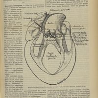 0459 - Page 449 - Revue générale. Ruptures spontanées de l'aorte ; par M. André Bergé... III. Étiologie / IV. Anatomie pathologique