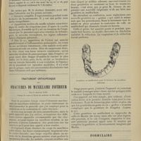0543 - Page 533 - Pneumonie sèche, chez une femme adulte non alcoolique ; par le Docteur A. Breton... / Traitement orthopédique des fractures du maxillaire inférieur ; par le Docteur Lop... / Formulaire. Pommade pour le pansement des brûlures