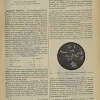 0829 - Page 819 - Les troubles de l'intestin chez les tuberculeux étudiés à l'aide des méthodes nouvelles de coprologie clinique ; par le Docteur René Gaultier...