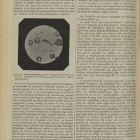 1034 - Page 1024 - Recherches sur la présence du spirochaete pallida dans le sang des syphilitiques ; par MM. P. Ravaut et A. Ponselle / Avis