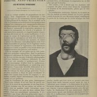 1357 - Page 1347 - Clinique chirurgicale. Dégénérescence tardive d'un fibrome naso-pharyngien avec métastase thyroïdienne ; par M. Jaboulay...