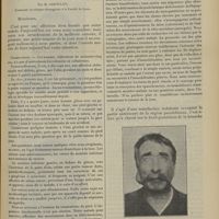 1741 - Page 1731 - Clinique chirurgicale. Tumeur mixte de la parotide ; par M. Jaboulay...