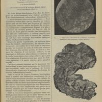 0189 - Page 183 - Les néoplasmes inflammatoires du colon pelvien ; par MM. P. Cavaillon..., et le Docteur Bardin. (Travail du service de M. le Docteur Bérard...)