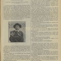 0261 - Page 255 - Mains de crocodile. Dermatose professionnelle produite par le bois de Chataignier ; par M. René Horand... (Travail de la clinique chirurgicale de M. le Professeur A. Poncet)