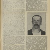 0357 - Page 351 - Thyroïdite pseudonéoplasique ; par M. Jaboulay...